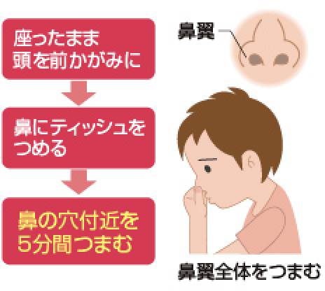 はなの症状 子どもの救急 病気 坂井耳鼻咽喉科 キッズサイト 愛知県春日井市 耳鼻科